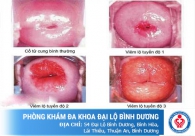 Viêm cổ tử cung và các triệu chứng thường gặp