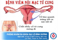 Những điều cần biết về bệnh viêm nội mạc tử cung ở nữ giới