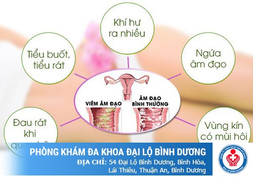 ngứa âm hộ