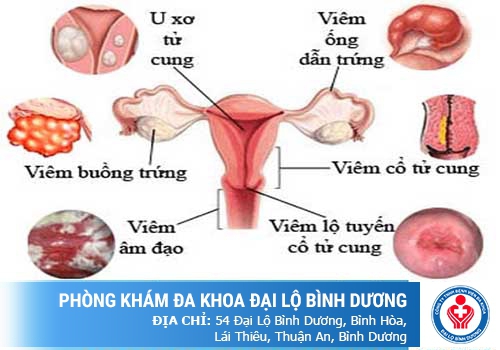 Khí hư bất thường là gì