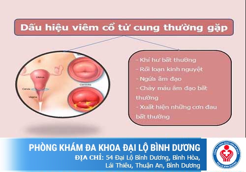 Cổ tử cung bị viêm